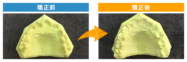 矯正後写真1