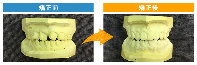 矯正後写真2
